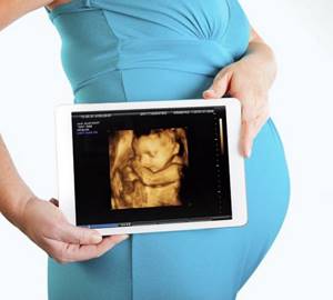 3D/4D ultrasound of the fetus