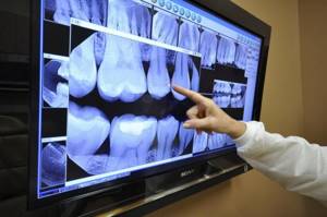 3D x-ray of teeth