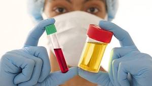 Blood and urine analysis