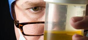 How to take a Sulkovich urine test?