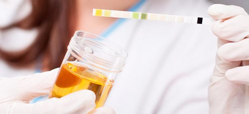 analysis of urine composition using test strips