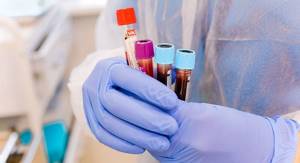 Blood tests at the international clinic Medica24