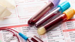 Blood tests. Types of blood tests. 