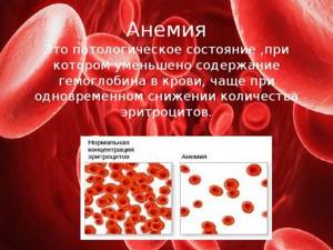 Anemia and a schematic representation of the normal number of red blood cells in the blood and anemia