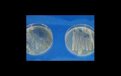 What you need to know about bacterial cultures