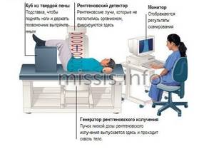 What is densitometry