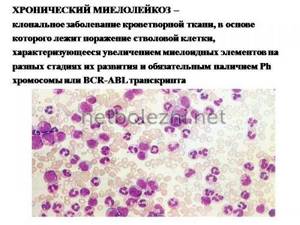What is myeloid leukemia