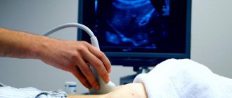 What is included in an abdominal ultrasound