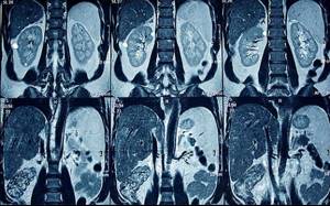 what can be seen on mri images