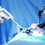 Diagnostic laparoscopy