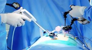 Diagnostic laparoscopy