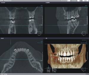 Why does an orthodontist need a CT scan?