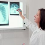 Доктора изучают результат рентгенографии костей носа