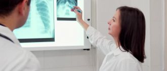 Doctors examine the result of an x-ray of the nasal bones