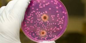 Yeast in a Petri dish