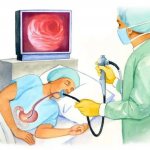 Endoscopy of the stomach
