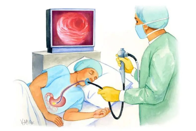 Endoscopy of the stomach