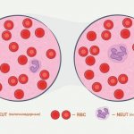 Red blood cells are the formed elements of blood; in blood tests they are abbreviated as RBC.