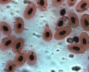 red blood cells under a microscope