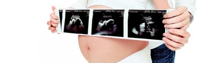 Photo of the result of ultrasound diagnostics of pregnancy
