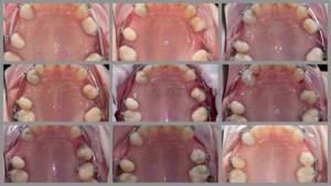 photography in orthodontics