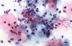 gram-positive rods in a smear