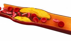 Cholesterol in the body: norms for different ages
