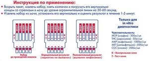 CTI urine analysis and its interpretation