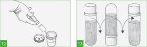 Instructions for collecting and processing spot urine samples