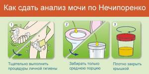 Interpretation of urine test results according to Nechiporenko in children