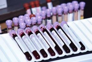 Image 1: Immunological blood test - Family Doctor clinic