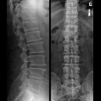 Image 2: Spine X-ray - Family Doctor Clinic