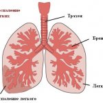 Image 3: Pneumonia - Family Doctor Clinic