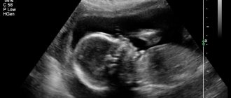 Fetal image obtained during 2nd trimester examination