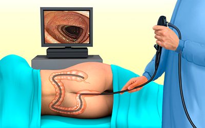 how is sigmoidoscopy performed photo