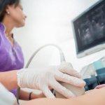 what types of ultrasound machines are there?