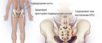 sacroiliac joints