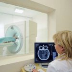 КТ головного мозга - снимки на томографе