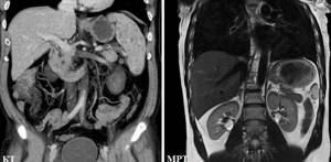 CT or MRI of internal organs
