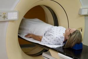 CT scan for hemorrhoids