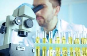 Laboratory urine analysis