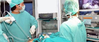laparoscopy to remove ovarian cyst
