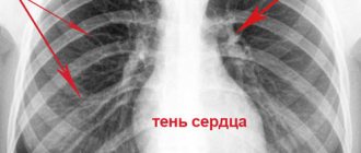 Lungs of a healthy person
