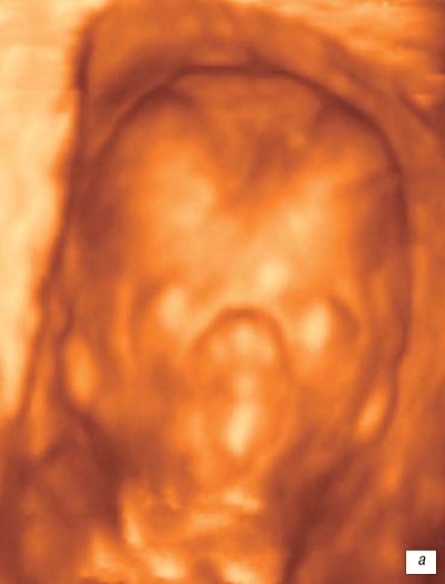 Fetal face during pregnancy 13 weeks