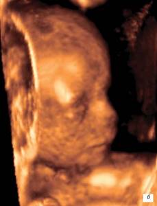 Fetal face during pregnancy 14 weeks
