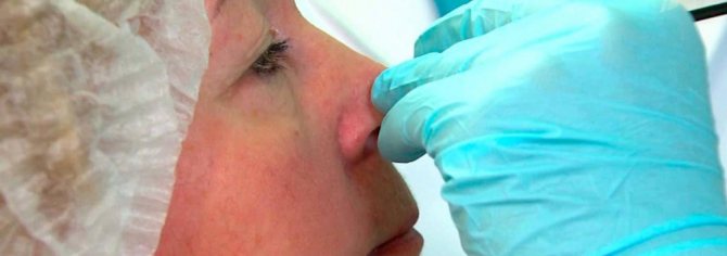 ЛОР-лечение аденоидов, полипов и искривленной перегородки носа