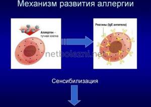 Mechanism of allergy development
