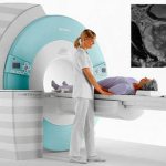 MRI diagnostics