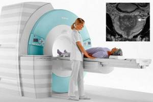 MRI diagnostics