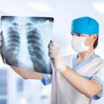 How effective is fluorography for pneumonia?